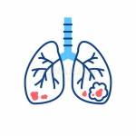LungCancerTreatment Hyderabad Profile Picture