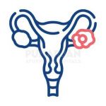 Ovarian Cancer Hyderabad Profile Picture