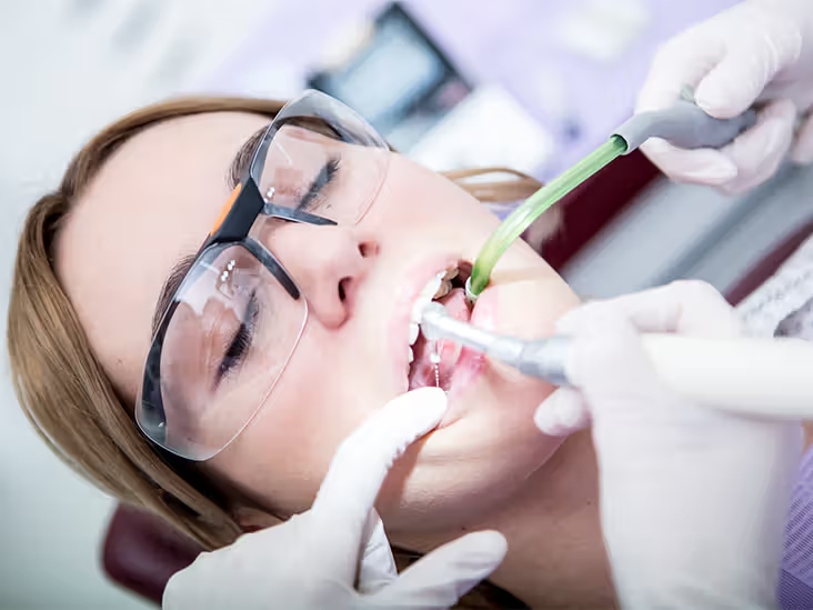 When Do You Need Root Canal Treatment in Mississauga