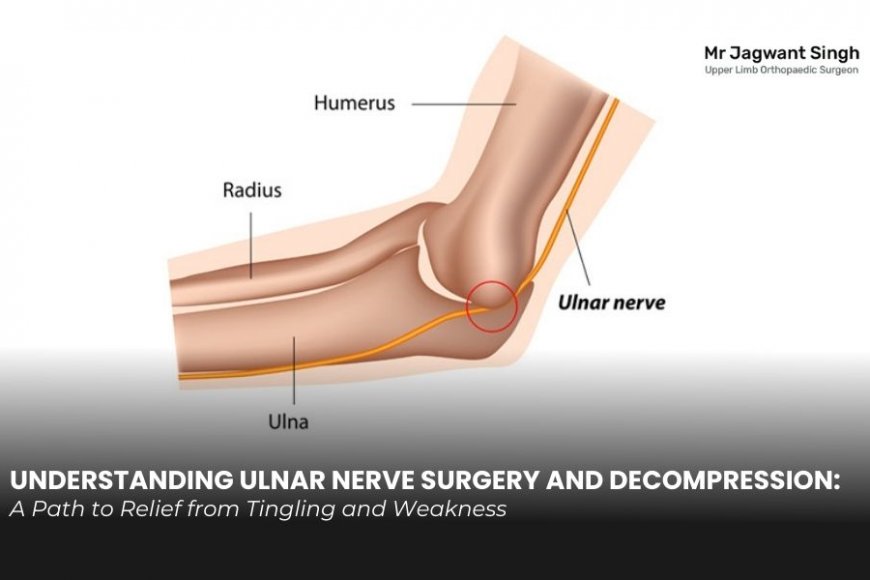 Understanding Ulnar Nerve Surgery and Decompression: A Path to Relief from Tingling and Weakness - Blogosm