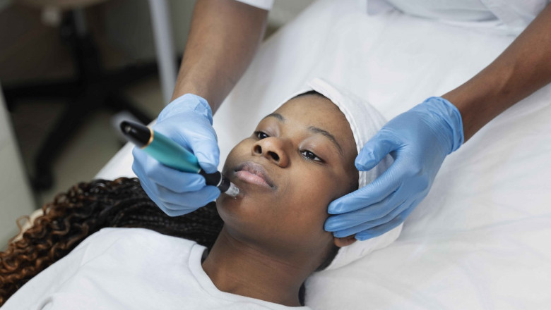 Step-by-Step Guide to Laser Hair Removal in Mississauga | NYC Newsly