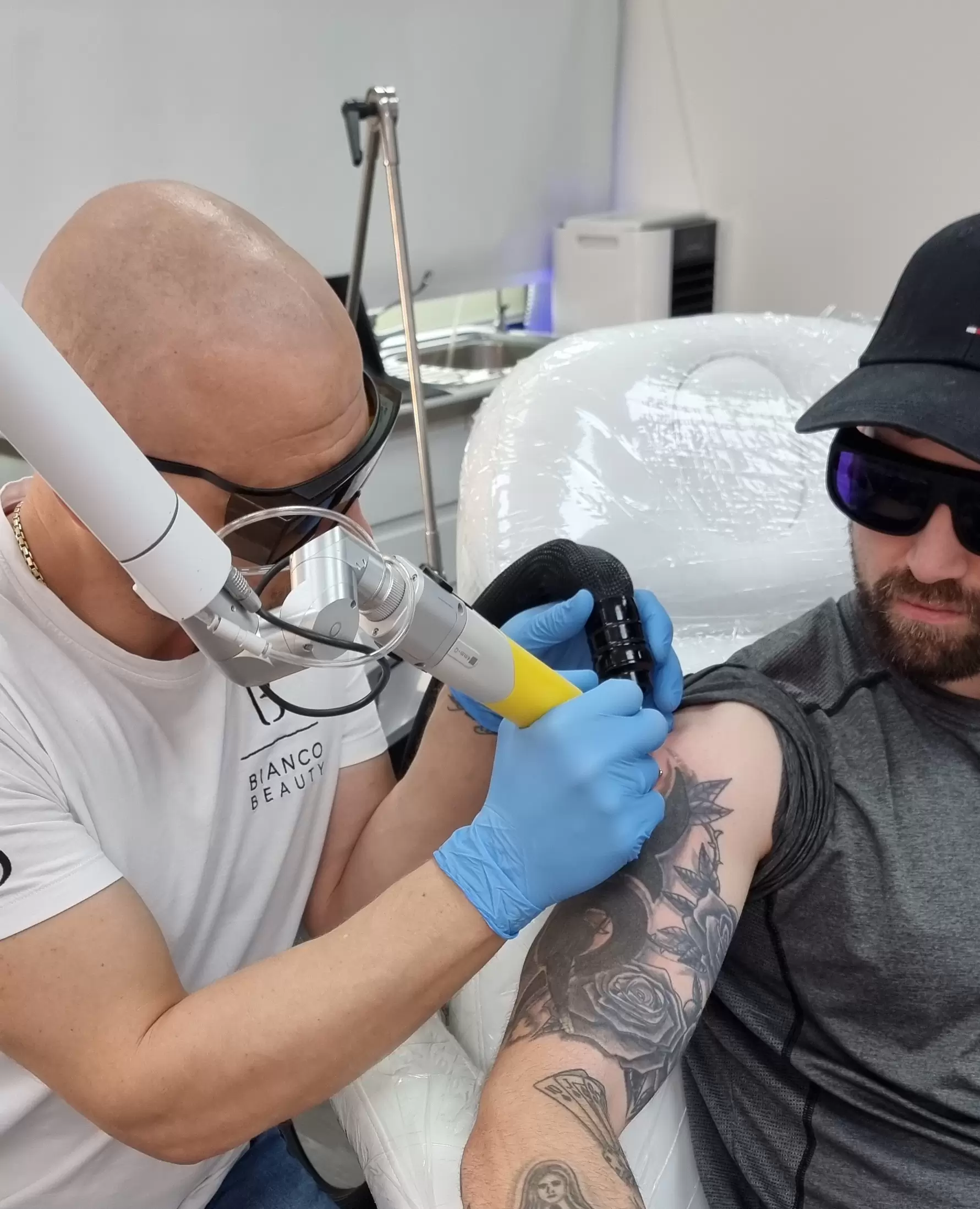 How Much Does Tattoo Removal Cost in London?