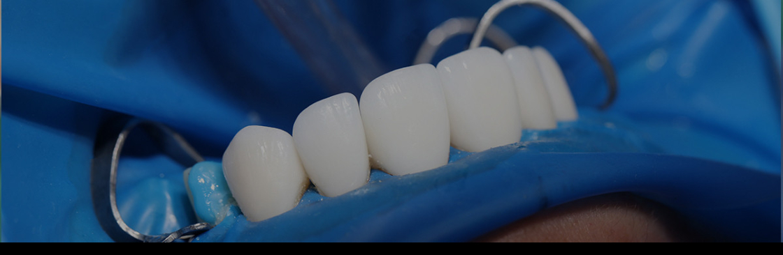 Teethsavers Dental Clinic Cover Image