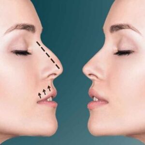 How to Care for a Cat Recovering from Hepatitis at Home? – Repur Tech