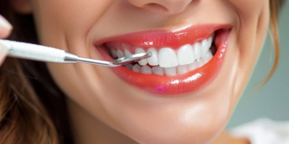 Dental Veneers Cost Breakdown Explained