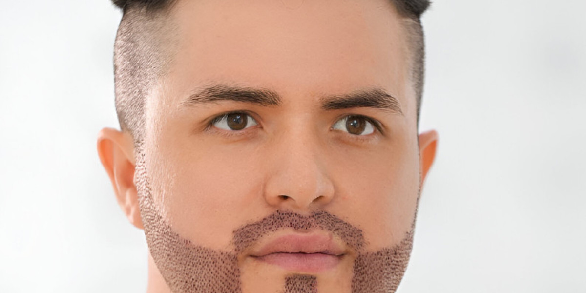 Highly Recommended Beard Transplant Experts in Islamabad