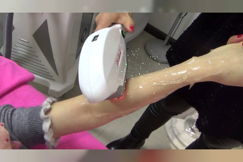 How SHR Hair Removal Provides Long-Lasting Smooth Skin by Mirage Aesthetic - Blogulr
