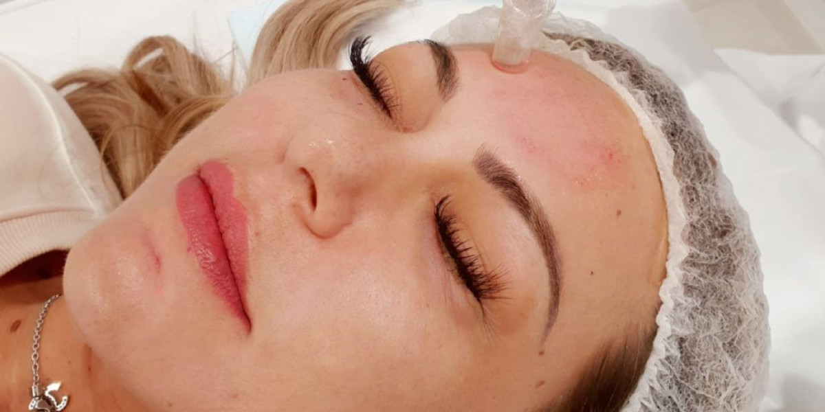 What Doesn't Work Well with Facial PRP Treatment?