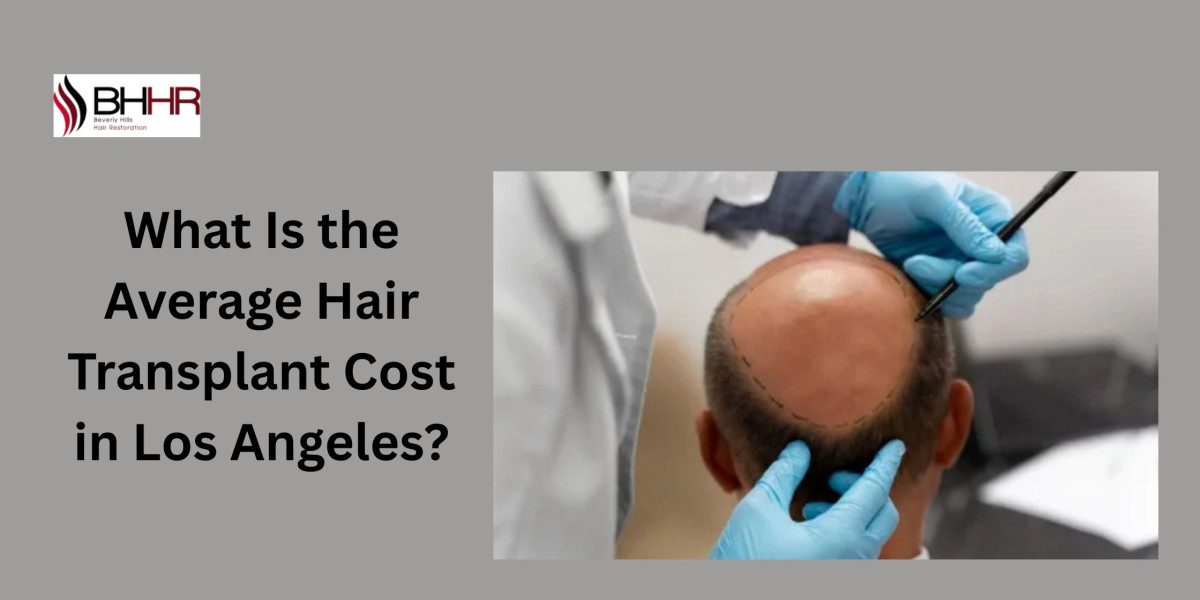 What Is the Average Hair Transplant Cost in Los Angeles?