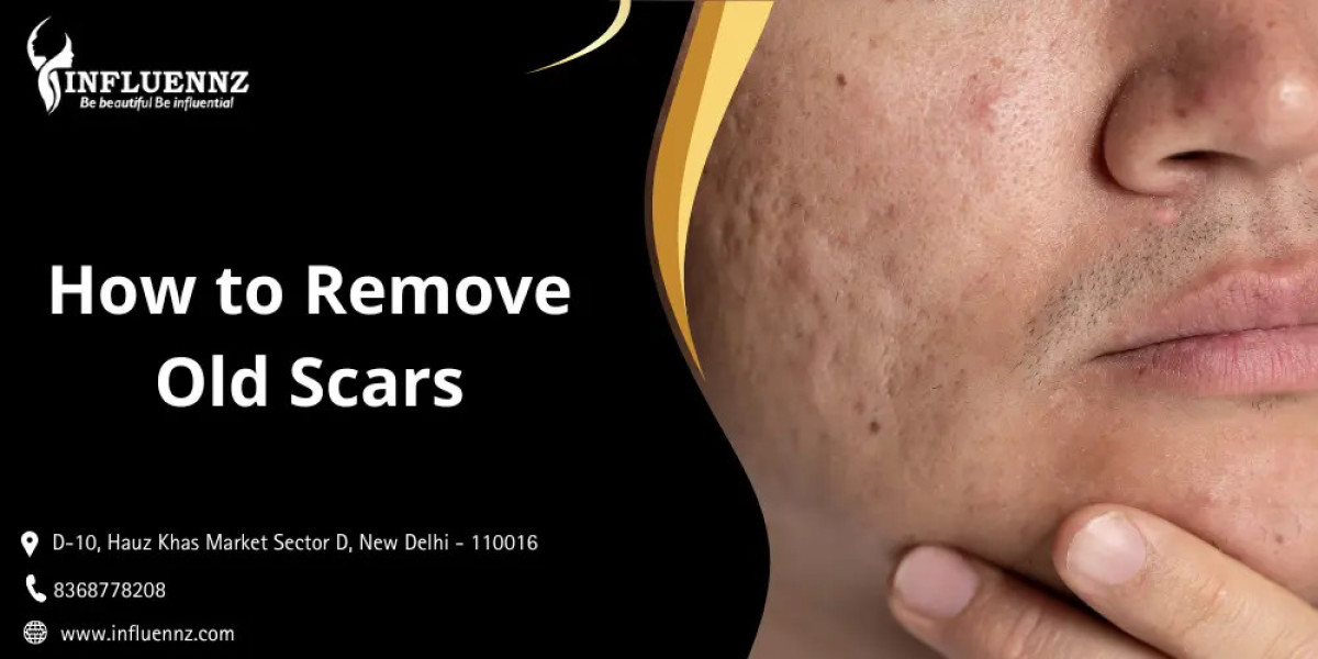 How to Remove Old Scars: Complete Dermatologist-Approved Guide