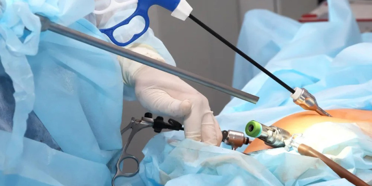 Laparoscopic Surgery for Pediatric Conditions