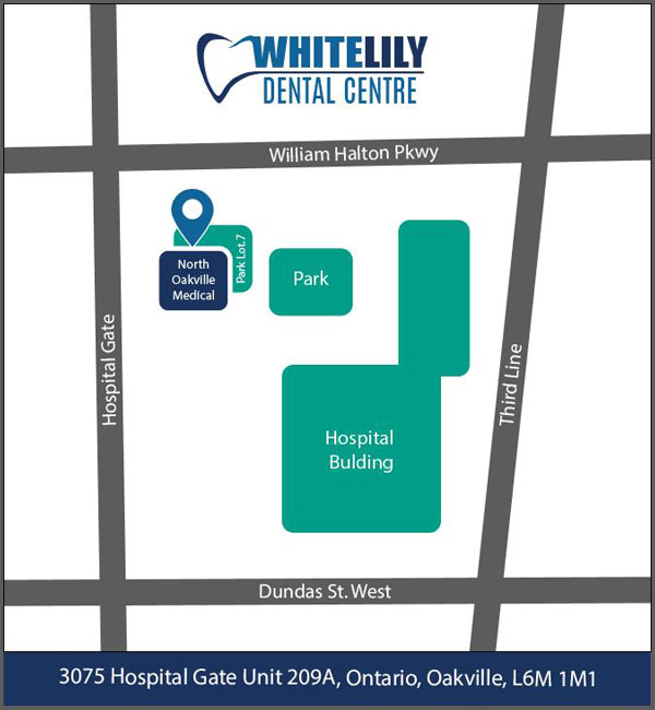 Teeth Whitening Oakville, ON