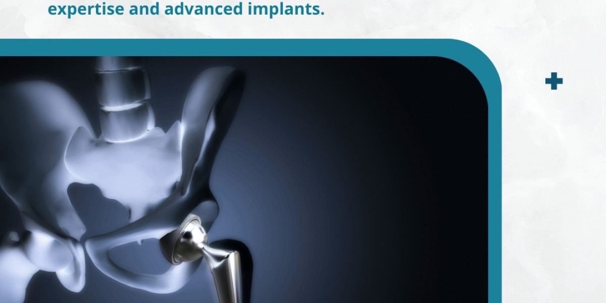 Restoring Mobility and Quality of Life: Expert Hip Replacement in Mumbai with Dr. Pradeep Nair