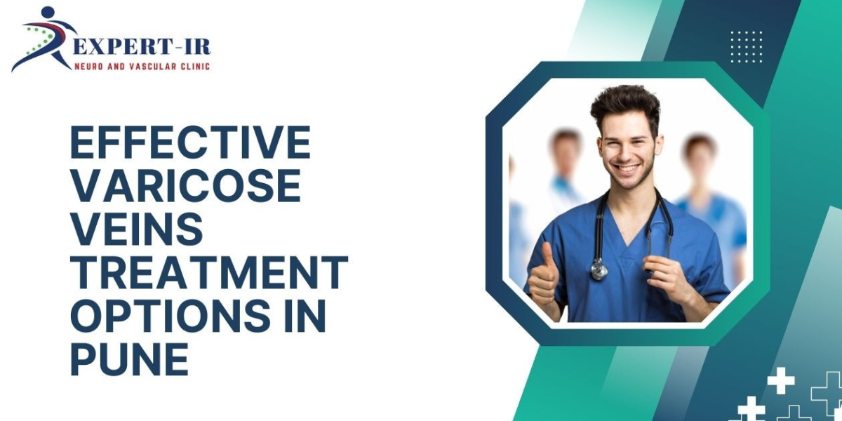 Advanced Varicose Veins Laser Treatment in Pune Explained