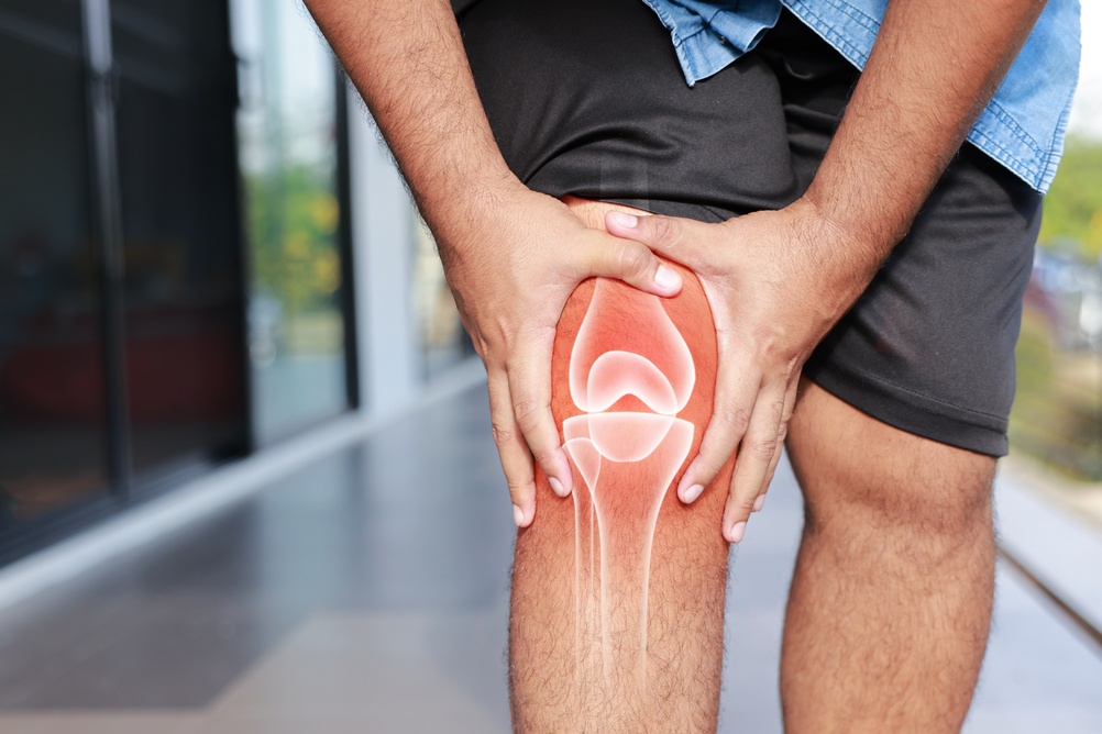 Who Is a Candidate for GAE Knee Treatment in Van Nuys?