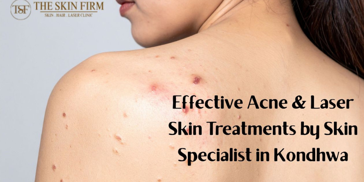 Advanced Laser Treatment in Pune | Skin Specialist in Kondhwa Guide