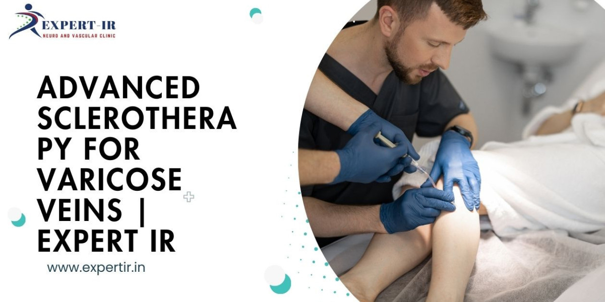 Trusted Clinic for Sclerotherapy for Varicose Veins
