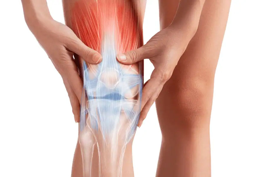How GAE Helps Treat Knee Arthritis Pain