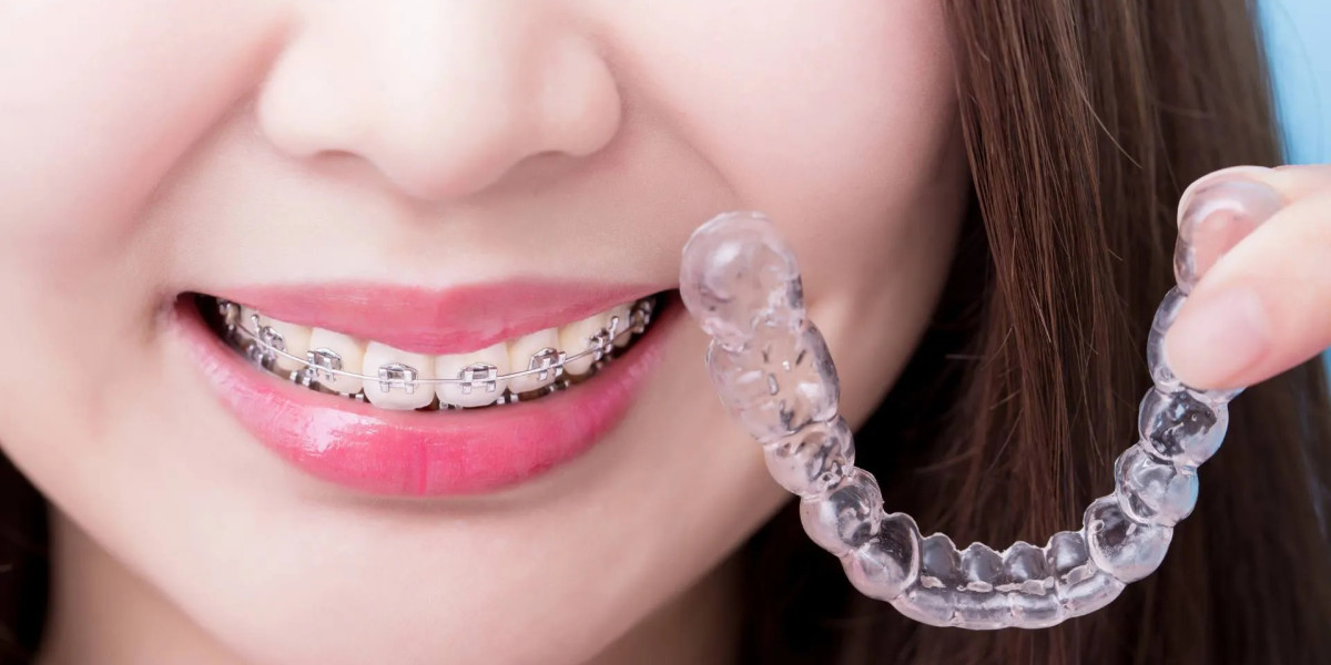 Invisalign Braces Treatment Cost: Budgeting for a Confident Smile