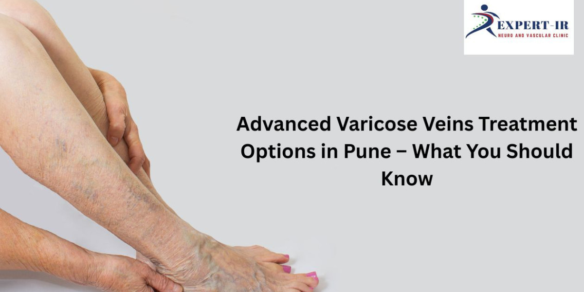 Complete Guide to Varicose Veins Laser Treatment in Pune