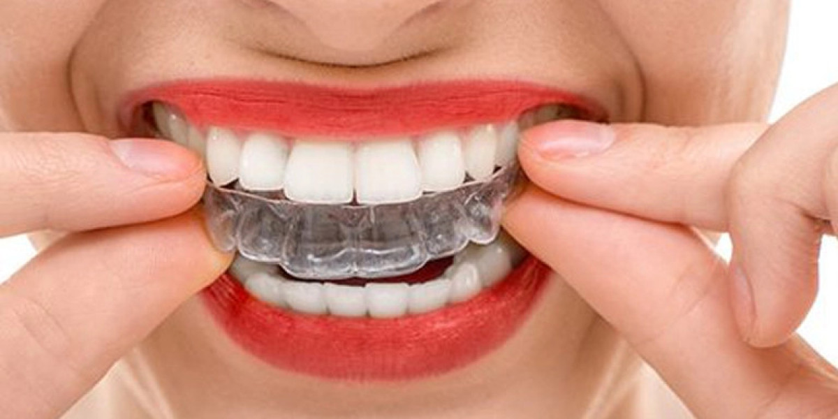 Invisalign Braces Treatment Cost Secrets For Perfect Smiles