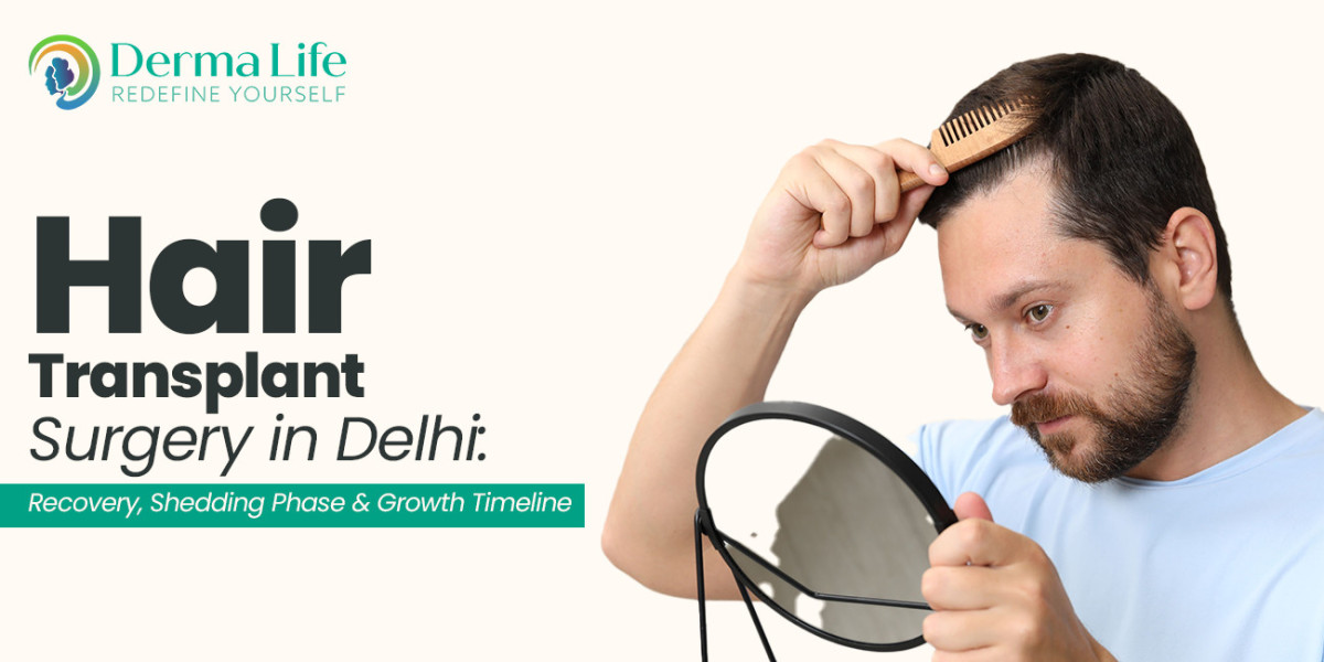Hair Transplant in Delhi: Best Hair Transplant Doctor, Clinic & Cost in Delhi, Noida and Gurgaon
