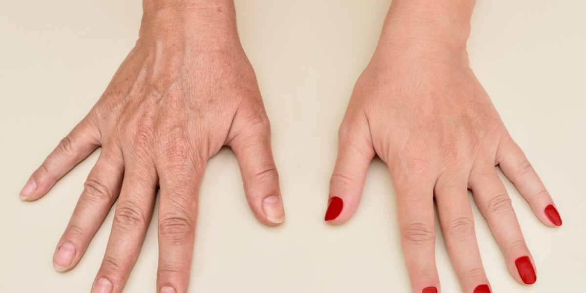 Transform Hands: Ageless Beauty Starts with Renewal