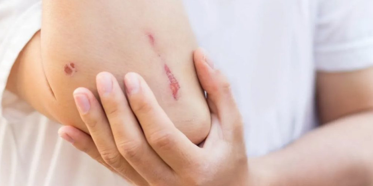 Urgent care for lacerations