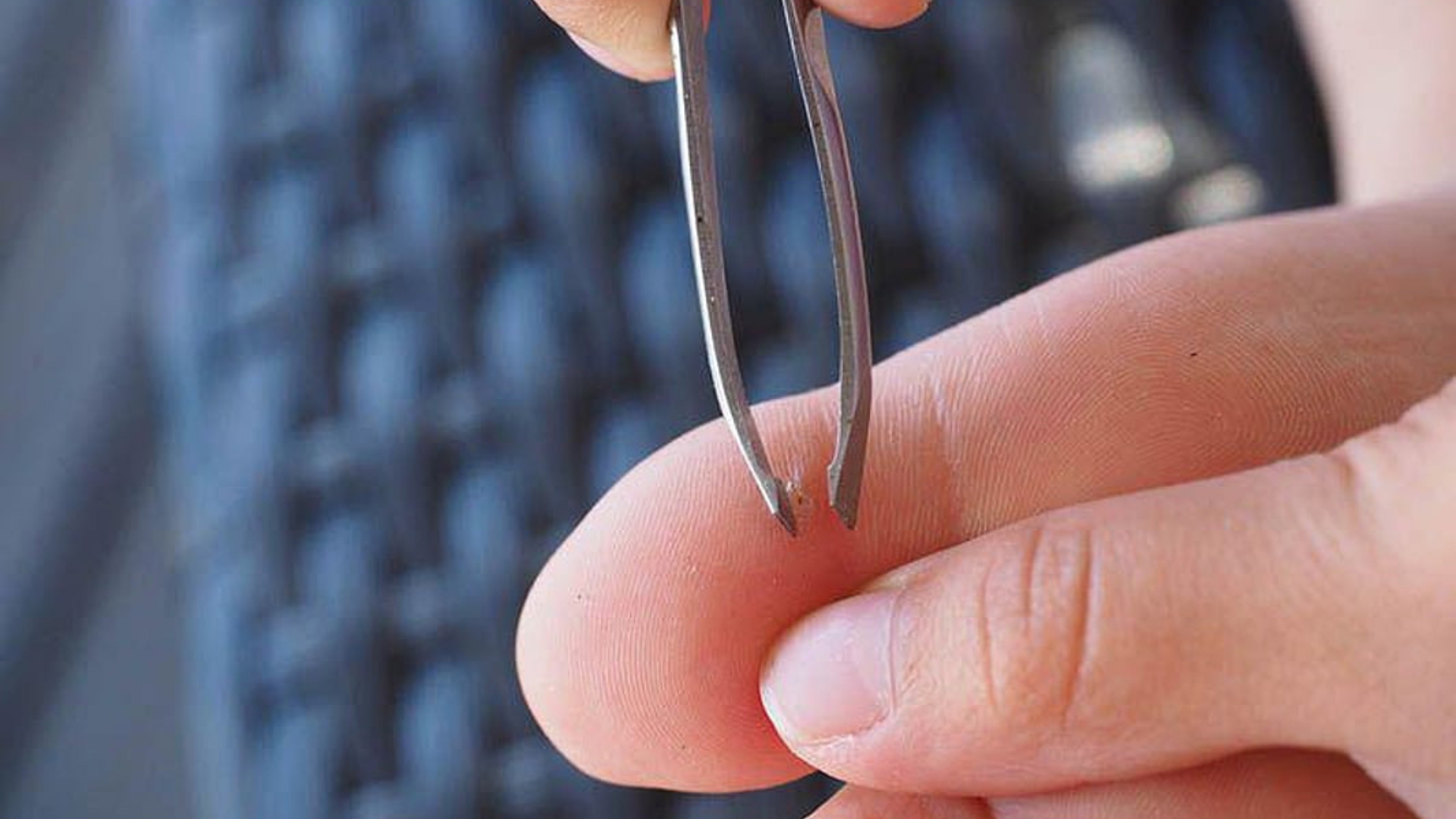 Foreign Body Removal | Interface Clinic