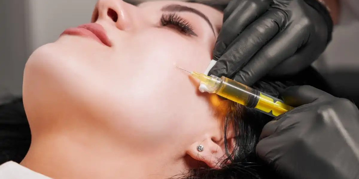 Is Microneedling Toronto the Secret to Clear, Smooth Skin?